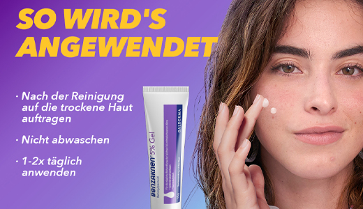 BENZAKNEN 5-prosenttinen geeli, 2X40 g