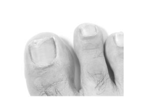 TERBINAFIN-1A Pharma Nagell.g.Nagelpilz 78.22mg/ml, 3.3 ml]