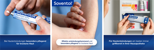 SOVENTOL Hydrocort 0,5 % voide, 30 g