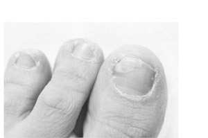 TERBINAFIN-1A Pharma Nagell.g.Nagelpilz 78.22mg/ml, 3.3 ml]