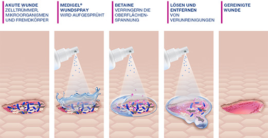 MEDIGEL Haavanpuhdistussuihke, 50 ml