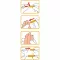 WELLION Safetylancets 28 G turvaemalit, 25 kpl