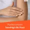 HYDROCORTISON-ratiopharm 0,5 % suihke, 30 ml