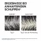 VICHY DERCOS Anti-Hilse shampoo kuivalle päänahalle, 390 ml