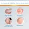 EndWarts® CLASSIC -liuos, 3 ml