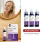 MINOXIDIL DoppelherzPharma 20 mg/ml liuos naisille, 3X60 ml