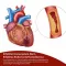 BEH Artery+ kapselit, 90 kpl